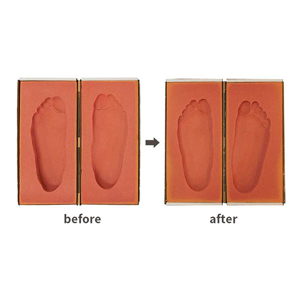 足底板療法